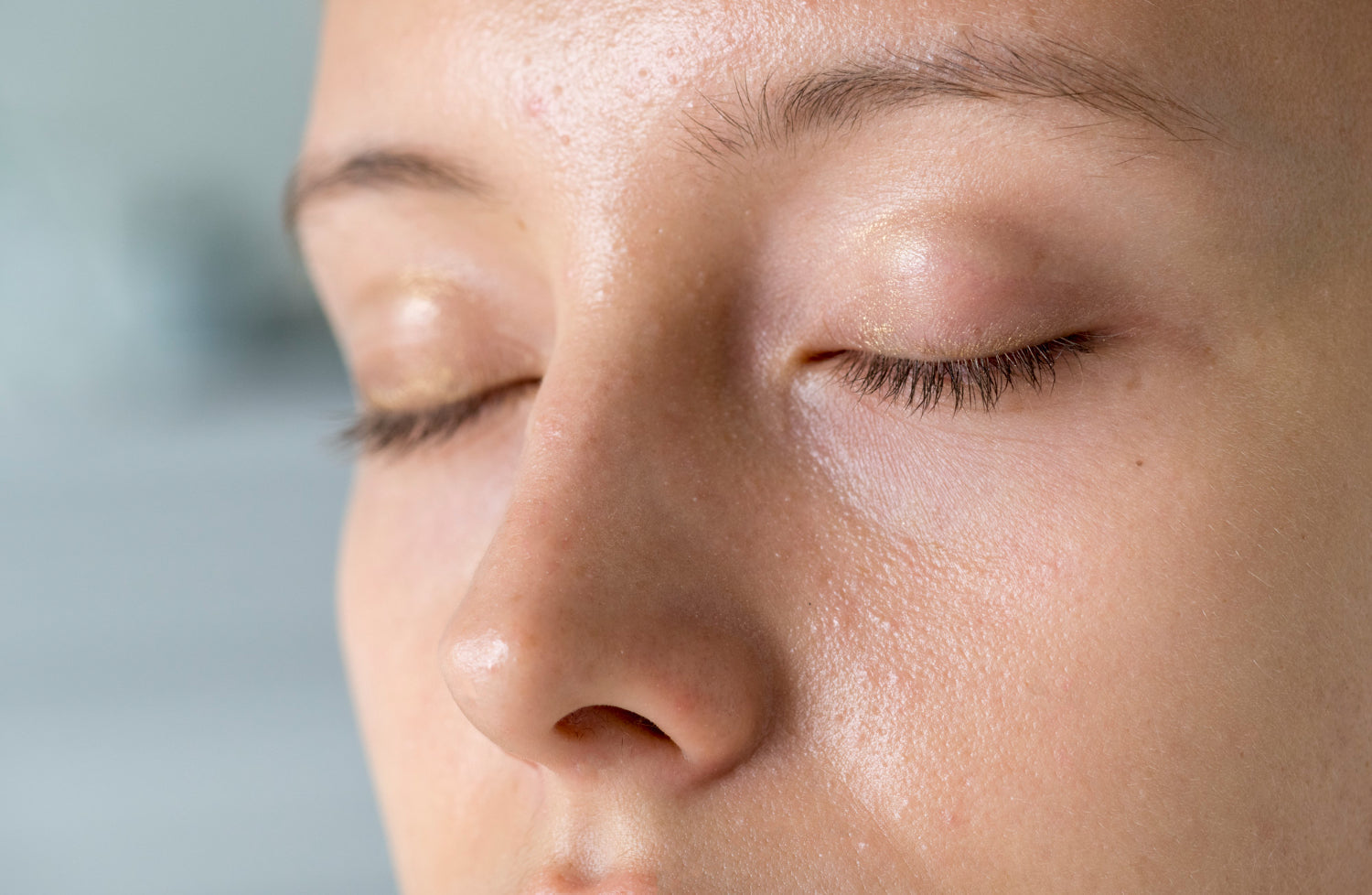 Rostro de una mujer mostrando poros visibles y textura brillante, evidenciando la necesidad de usar un maquillaje dermatológico para piel grasa.