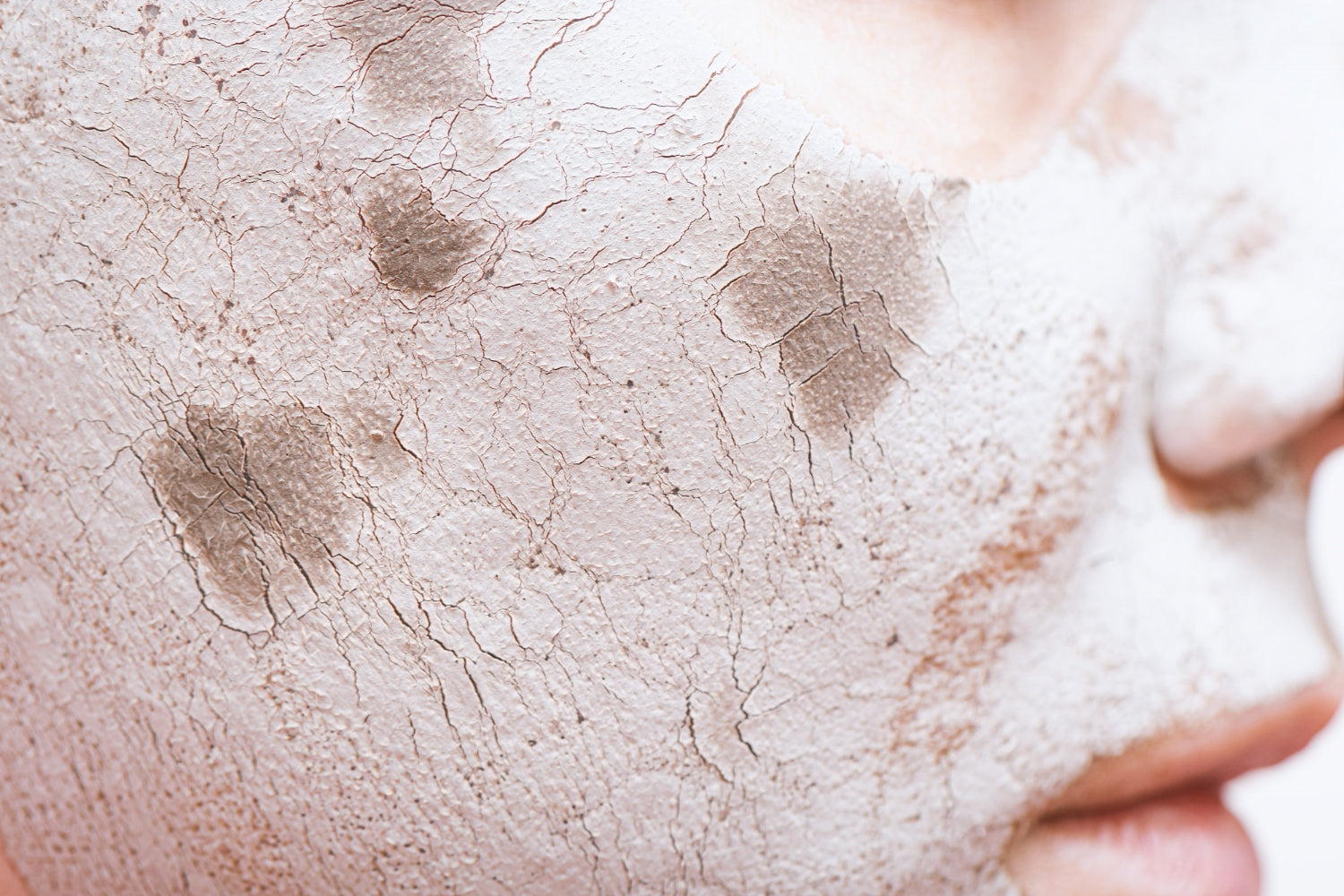 Simulación de una piel con textura extremadamente seca y agrietada como ejemplo de una barrera cutánea dañada.