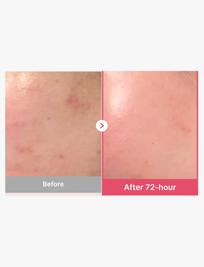 TXA Niacinamide 15 Serum