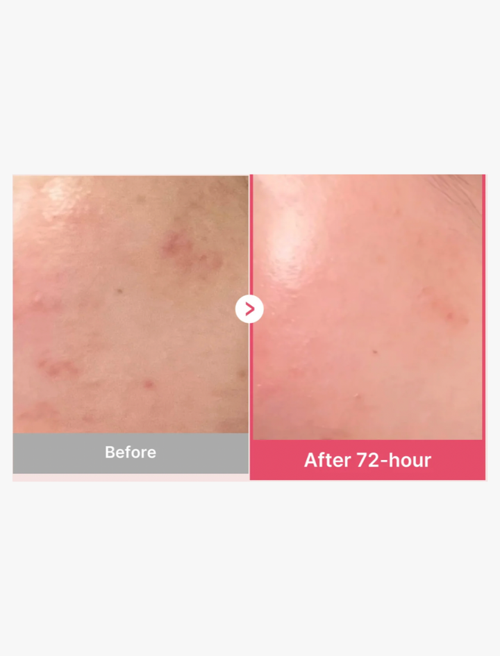 TXA Niacinamide 15 Serum