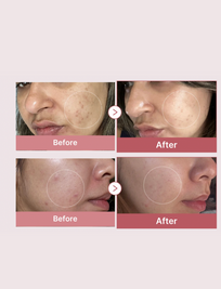 PDRN Pink Peptide Serum