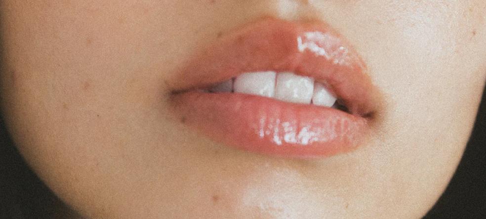 Labios